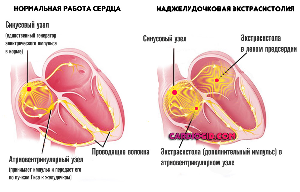 Гликозиды и инфаркт миокарда thumbnail