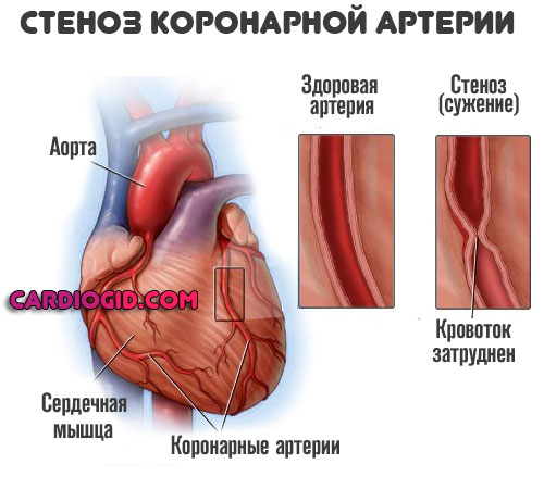 Давление в норме сердцебиение повышенное давление thumbnail