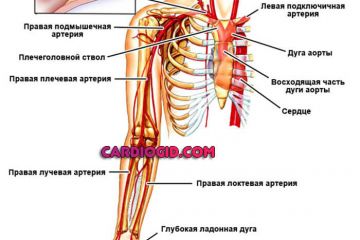 атеросклероз-подключичной-артерии