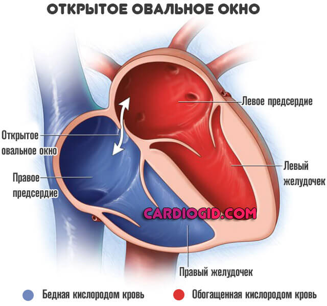 Можно ли делать эхо сердца при болезни thumbnail