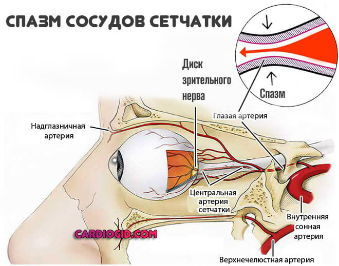Болевой синдром связанный со спазмом периферических артерий thumbnail