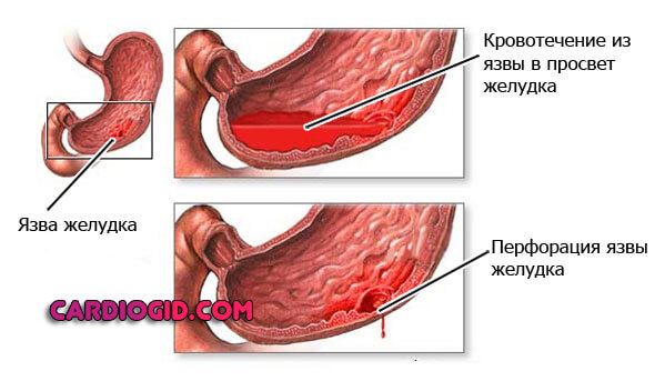 Какова норма гемоглобина у мужчин thumbnail