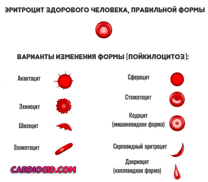 Анизоцитоз пойкилоцитоз в анализе крови thumbnail
