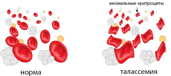 Что такое анемия микроцитоз микроциты thumbnail