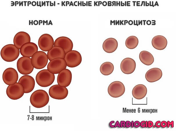 Mcv анализ крови расшифровка понижен thumbnail